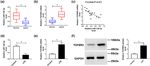 MiR-128-3p inhibits apoptosis and inflammation in LPS-induced sepsis by targeting TGFBR2