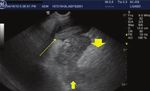 Comparison of clinical findings in 293 dogs with suspect acute pancreatitis: Different clinical presentation with left lobe, right lobe or diffuse ...