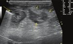 Comparison of clinical findings in 293 dogs with suspect acute pancreatitis: Different clinical presentation with left lobe, right lobe or diffuse ...