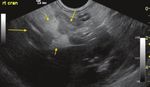 Comparison of clinical findings in 293 dogs with suspect acute pancreatitis: Different clinical presentation with left lobe, right lobe or diffuse ...