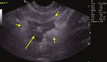 Comparison of clinical findings in 293 dogs with suspect acute pancreatitis: Different clinical presentation with left lobe, right lobe or diffuse ...