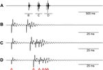 A DESCRIPTION OF THE MALE DRUMMING CALL OF BESDOLUS VENTRALIS (PICTET, 1841) (PLECOPTERA: PERLODIDAE)