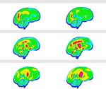 Deep learning methodology for predicting time history of head angular kinematics from simulated crash videos