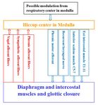 Intraoperative Laryngeal Mask Airway-Related Hiccup: An Overview
