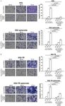 Original Article Collagen type VI regulates the CDK4/6-p-Rb signaling pathway and promotes ovarian cancer invasiveness, stemness, and metastasis