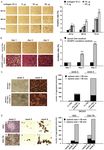 Original Article Collagen type VI regulates the CDK4/6-p-Rb signaling pathway and promotes ovarian cancer invasiveness, stemness, and metastasis