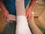 Integrated therapy approach in patients with lymphedema of different etiology with chronic wounds leads to successful outcome in wound healing and ...