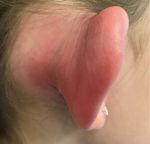 If Not Otitis Externa Then What? - Clinical - Journal of Urgent Care ...