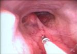Rhinosinusitis in Companion Animals - Mini Review - Austin Publishing Group