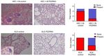 Lower expression of PDZRN3 induces endometrial carcinoma progression via the activation of canonical Wnt signaling