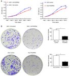 Lower expression of PDZRN3 induces endometrial carcinoma progression via the activation of canonical Wnt signaling