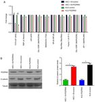 Lower expression of PDZRN3 induces endometrial carcinoma progression via the activation of canonical Wnt signaling