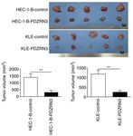 Lower expression of PDZRN3 induces endometrial carcinoma progression via the activation of canonical Wnt signaling