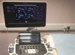 Ultrasound scan of the abdomen and pelvis - Radiology Department - Royal Surrey County ...