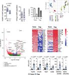 Characterisation of peri-implantation endometrial Treg and identification of an altered phenotype in recurrent pregnancy loss