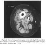 Adrenaline Auto-injectors: A Review of Clinical and Quality Considerations - 04 June 2014