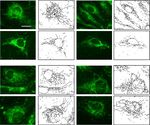 Essential role for paxillin tyrosine phosphorylation in LPS induced mitochondrial fission, ROS generation and lung endothelial barrier loss