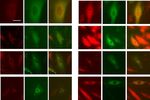 Essential role for paxillin tyrosine phosphorylation in LPS induced mitochondrial fission, ROS generation and lung endothelial barrier loss