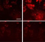 Essential role for paxillin tyrosine phosphorylation in LPS induced mitochondrial fission, ROS generation and lung endothelial barrier loss