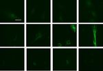 Essential role for paxillin tyrosine phosphorylation in LPS induced mitochondrial fission, ROS generation and lung endothelial barrier loss