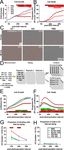 AAV ablates neurogenesis in the adult murine hippocampus