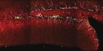 AAV ablates neurogenesis in the adult murine hippocampus