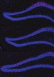 AAV ablates neurogenesis in the adult murine hippocampus