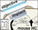 AAV ablates neurogenesis in the adult murine hippocampus
