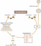 Obesity and Thyroid Axis - Review - MDPI