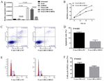 Promoter hypermethylation influences the suppressive role of long non coding RNA MEG3 in the development of multiple myeloma