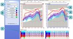 AURICAL FreeFit Otosuite PMM Module Otosuite Counseling and Simulations Module - User Guide - Natus Partner