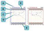 AURICAL FreeFit Otosuite PMM Module Otosuite Counseling and Simulations Module - User Guide - Natus Partner