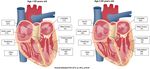 Kammertachykardien: Wann abladieren? - Cardio Update 05/2021 - Patrick Badertscher