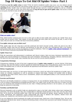 Top 10 Ways To Get Rid Of Spider Veins