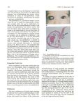 Imaging of Developmental Anomalies of the Eye and the Orbit