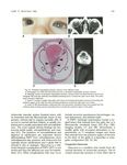 Imaging of Developmental Anomalies of the Eye and the Orbit
