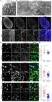 Conduit integrity is compromised during acute lymph node expansion - bioRxiv