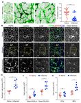 Conduit integrity is compromised during acute lymph node expansion - bioRxiv