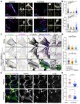 Conduit integrity is compromised during acute lymph node expansion - bioRxiv
