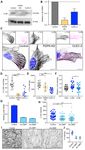 Conduit integrity is compromised during acute lymph node expansion - bioRxiv