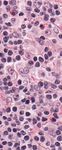 Teaching Cases in Hematology: A Virtual Slide Atlas - Jason C. Ford, MD, FRCP(C) Sophia Wong 2009 - Pathology and Laboratory ...