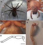 The recent expansion of Chilean recluse Loxosceles laeta (Nicolet) (Arachnida: Araneae) in Southern Patagonia