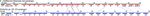Comparative Analysis of Genome of Ehrlichia sp. HF, a Model Bacterium to Study Fatal Human Ehrlichiosis