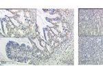 G Protein-Coupled Estrogen Receptor Correlates With Dkk2 Expression and Has Prognostic Impact in Ovarian Cancer Patients - Frontiers