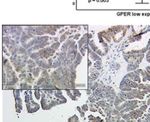 G Protein-Coupled Estrogen Receptor Correlates With Dkk2 Expression and Has Prognostic Impact in Ovarian Cancer Patients - Frontiers