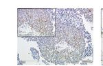 G Protein-Coupled Estrogen Receptor Correlates With Dkk2 Expression and Has Prognostic Impact in Ovarian Cancer Patients - Frontiers