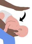 ANZCOR Guideline 4 - Airway - Summary - New Zealand Resuscitation ...