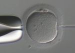 Intracytoplasmic Sperm Injection (ICSI) with the Eppendorf micromanipulator TransferMan 4m