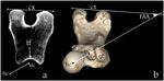 Measurement of the Femoral Anteversion Angle in Medium and Large Dog Breeds Using Computed Tomography