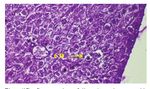 Histopathological Changes in Liver Induced by Piroxicam Administration in Adult Male Albino Mice Mus musculus